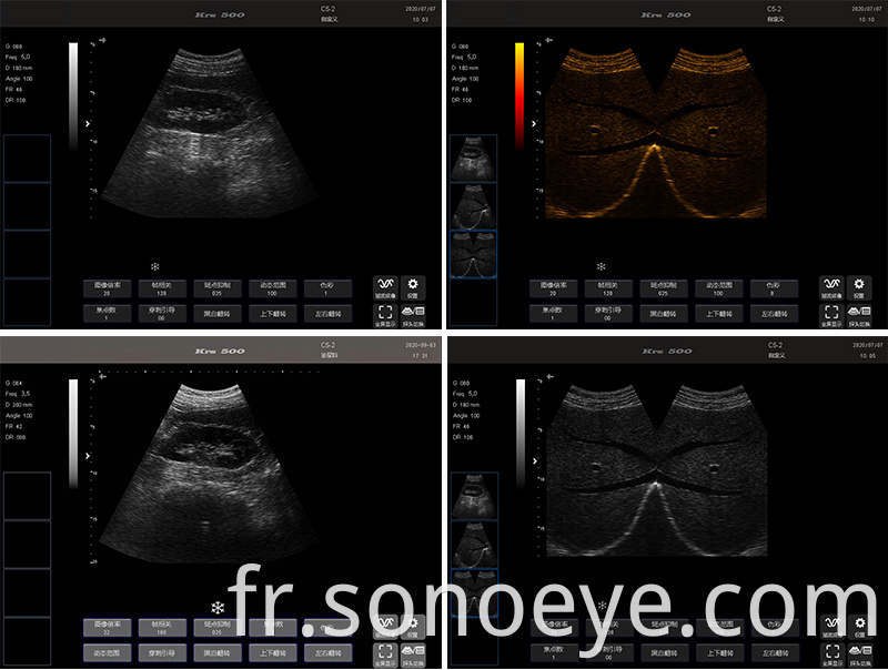 porket ultrasound